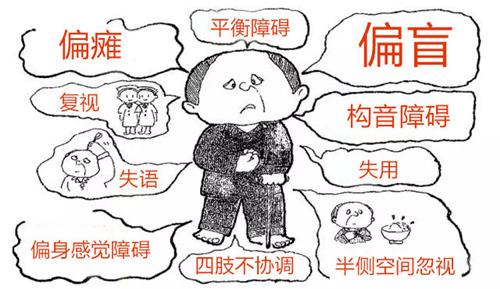 小脑梗塞怎样恢复