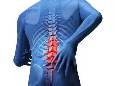 腰椎间盘突出患者在日常生活该注意哪些?又该如何锻炼?