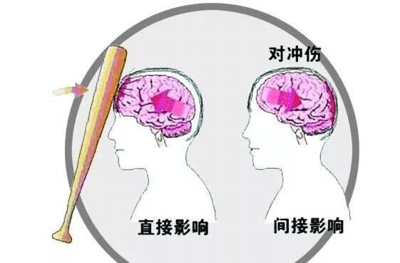 脑外伤一个月为康复黄金期 如何治疗效果最好?