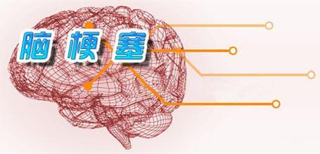 造成脑梗塞的3大原因!